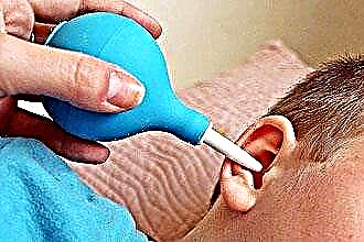 Bagaimana cara menghilangkan kotoran di telinga?
