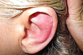 What to drip into the ear if it hurts?