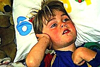 Hur man behandlar öroninflammation hos ett barn