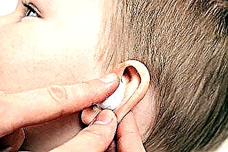 中耳炎の治療におけるコマロフスキーの方法についてのすべて