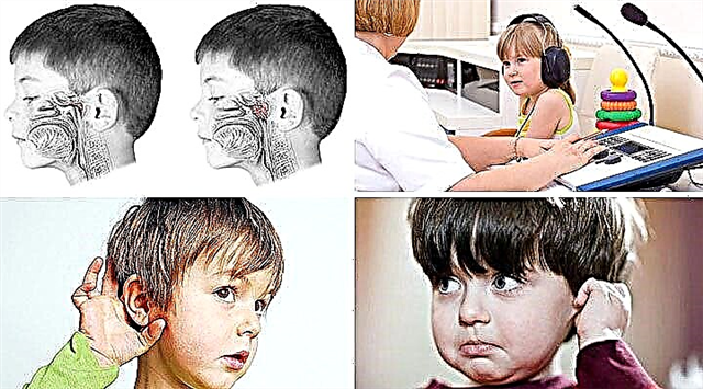 Причини за възпаление на средното ухо при деца