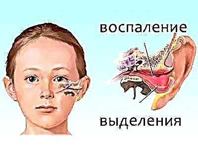 Príznaky a príznaky zápalu stredného ucha u dieťaťa od 1 do 3 rokov