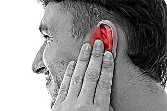 Środki przeciwbólowe i krople na zapalenie ucha środkowego u dorosłych
