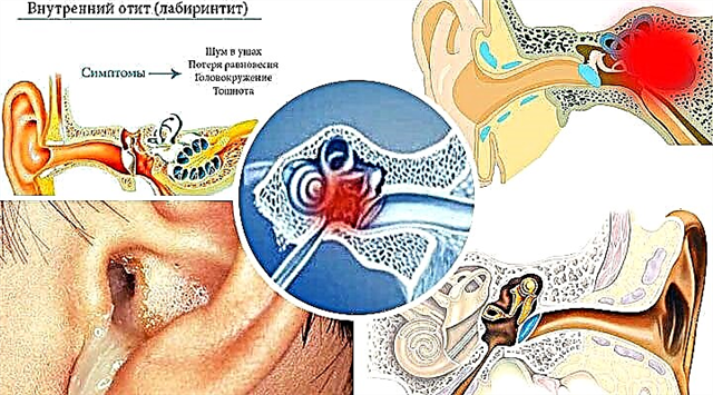 هل من الممكن الخروج مع التهاب الأذن الوسطى؟