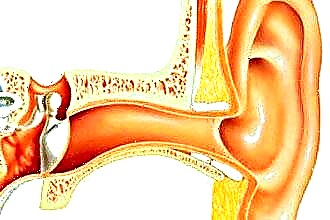 التهاب الأذن الوسطى نضحي أو مهدئ